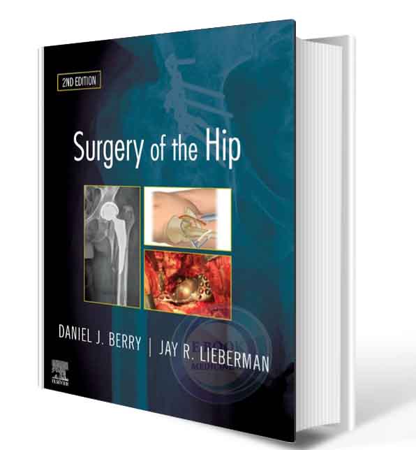 دانلود کتاب Surgery of the Hip: Expert Consult - Online and Print 2nd 2019 (ORIGINAL PDF)